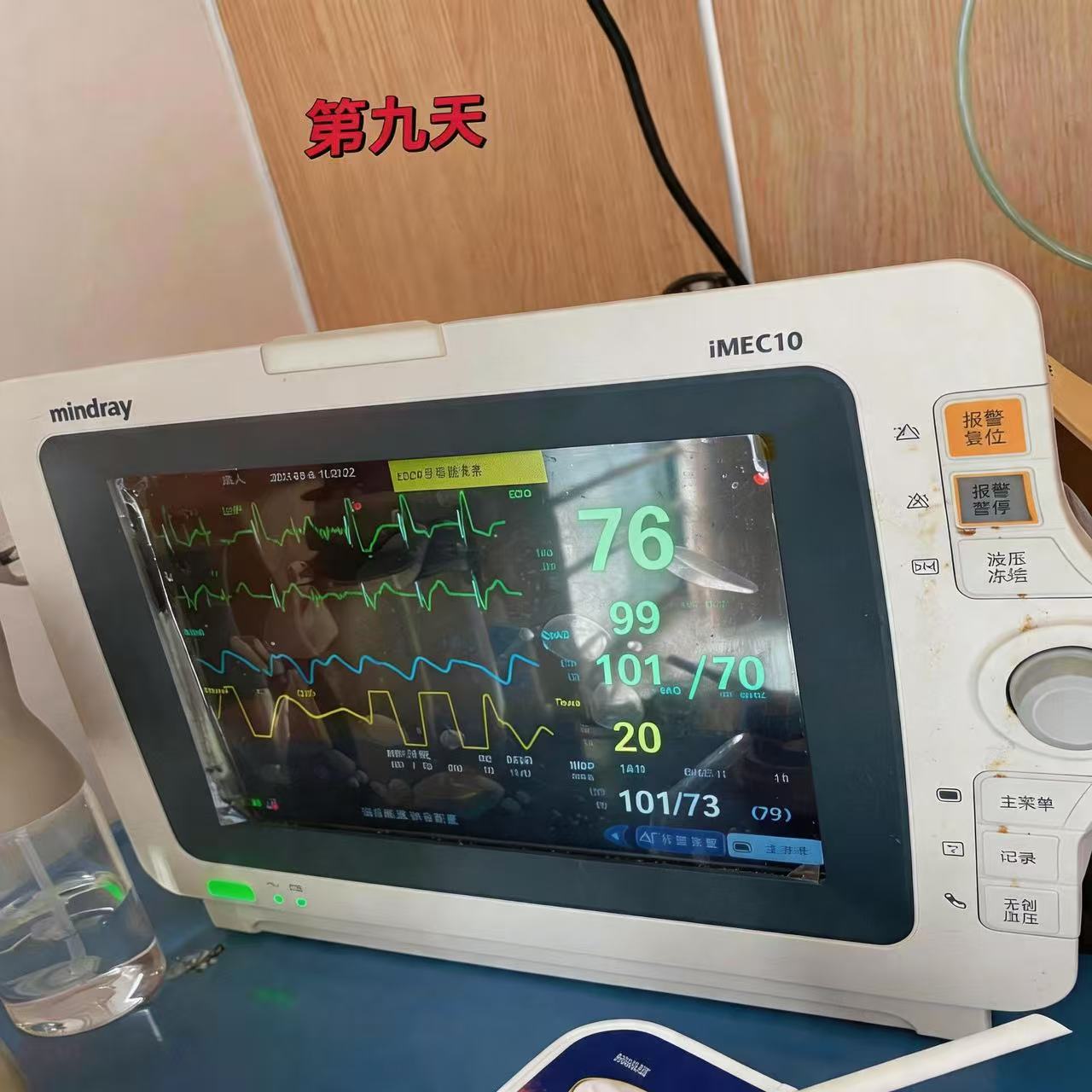 Refurbished Patient Monitor