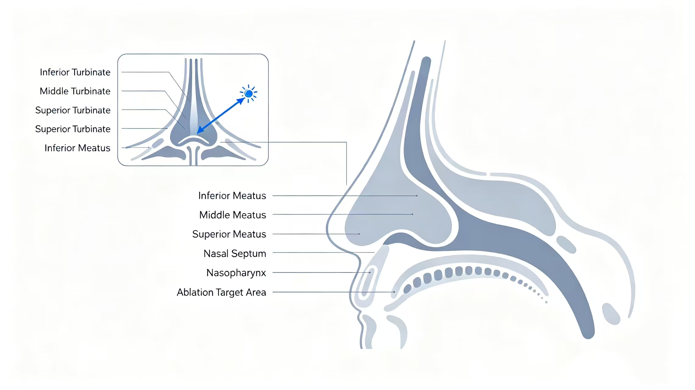 Coblation surgical system – minimally invasive platform for orthopedic arthroscopy and ENT procedures Coblation surgical system – minimally invasive platform for orthopedic arthroscopy and ENT procedures