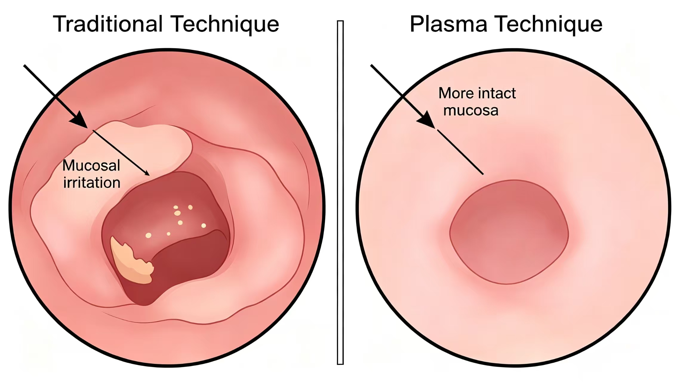 Patient applying ice pack to nose after coblation turbinate reduction, recovering comfortably at home or clinic Patient applying ice pack to nose after coblation turbinate reduction, recovering comfortably at home or clinic