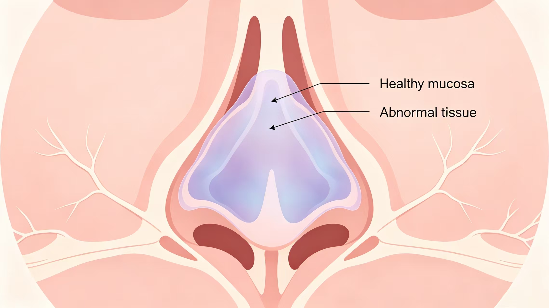 Modern ENT surgery precision, safety, and faster recovery