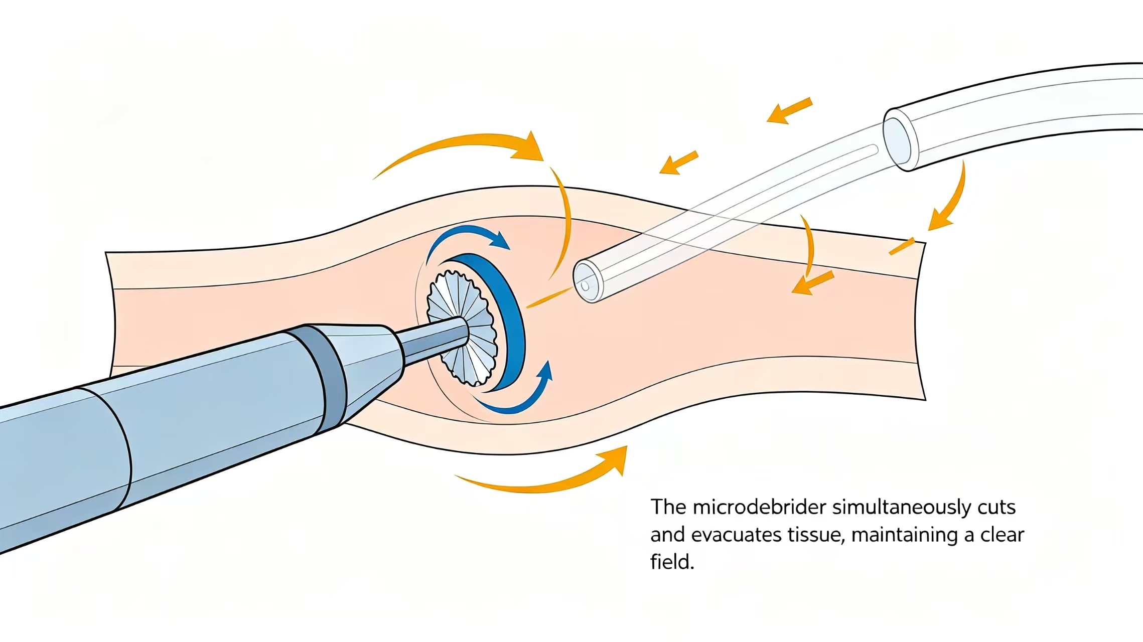 Modern ENT surgery precision, safety, and faster recovery