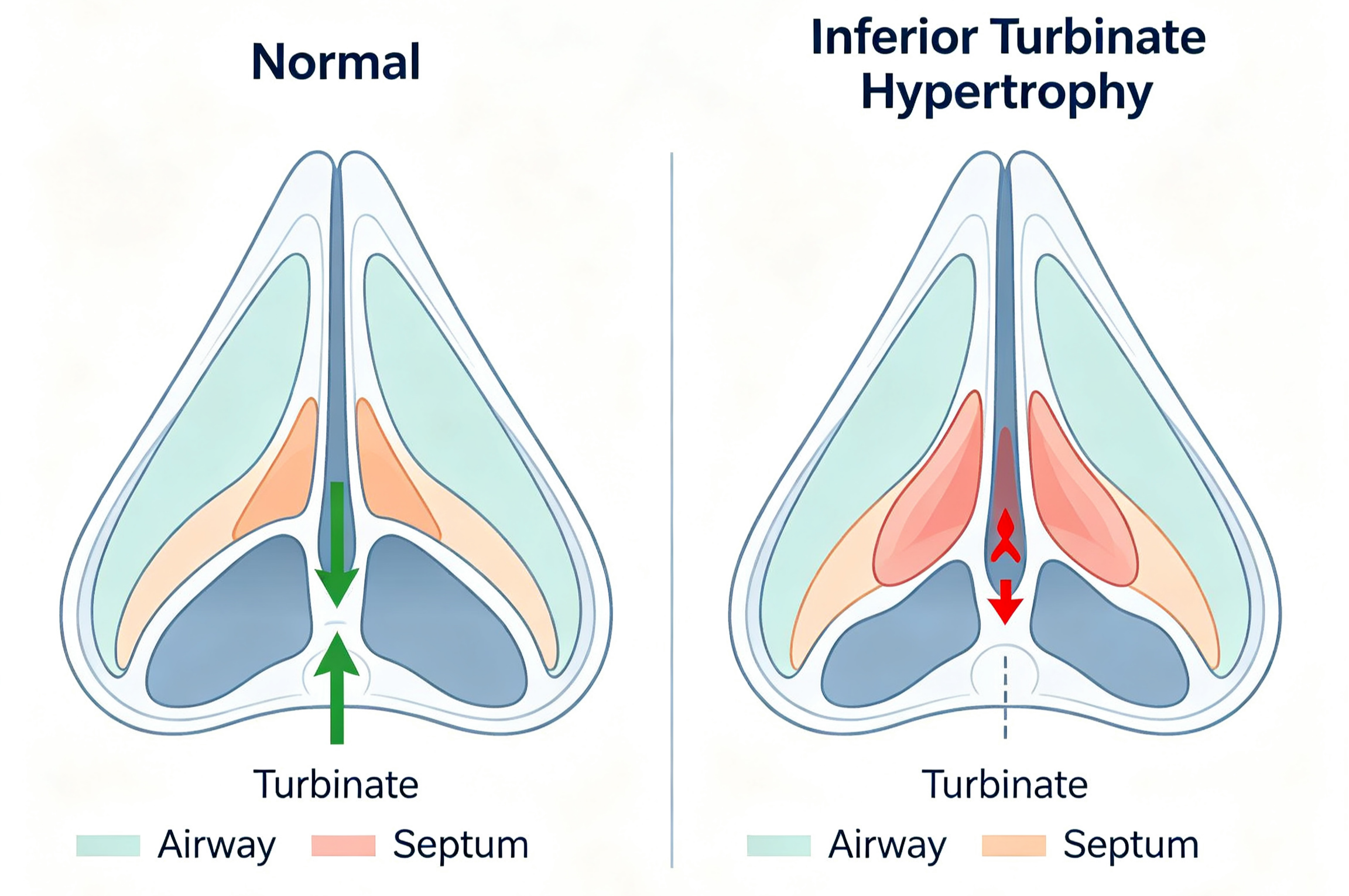 nose silhouette with blue plasma glow, minimally invasive tech concept. nose silhouette with blue plasma glow, minimally invasive tech concept.