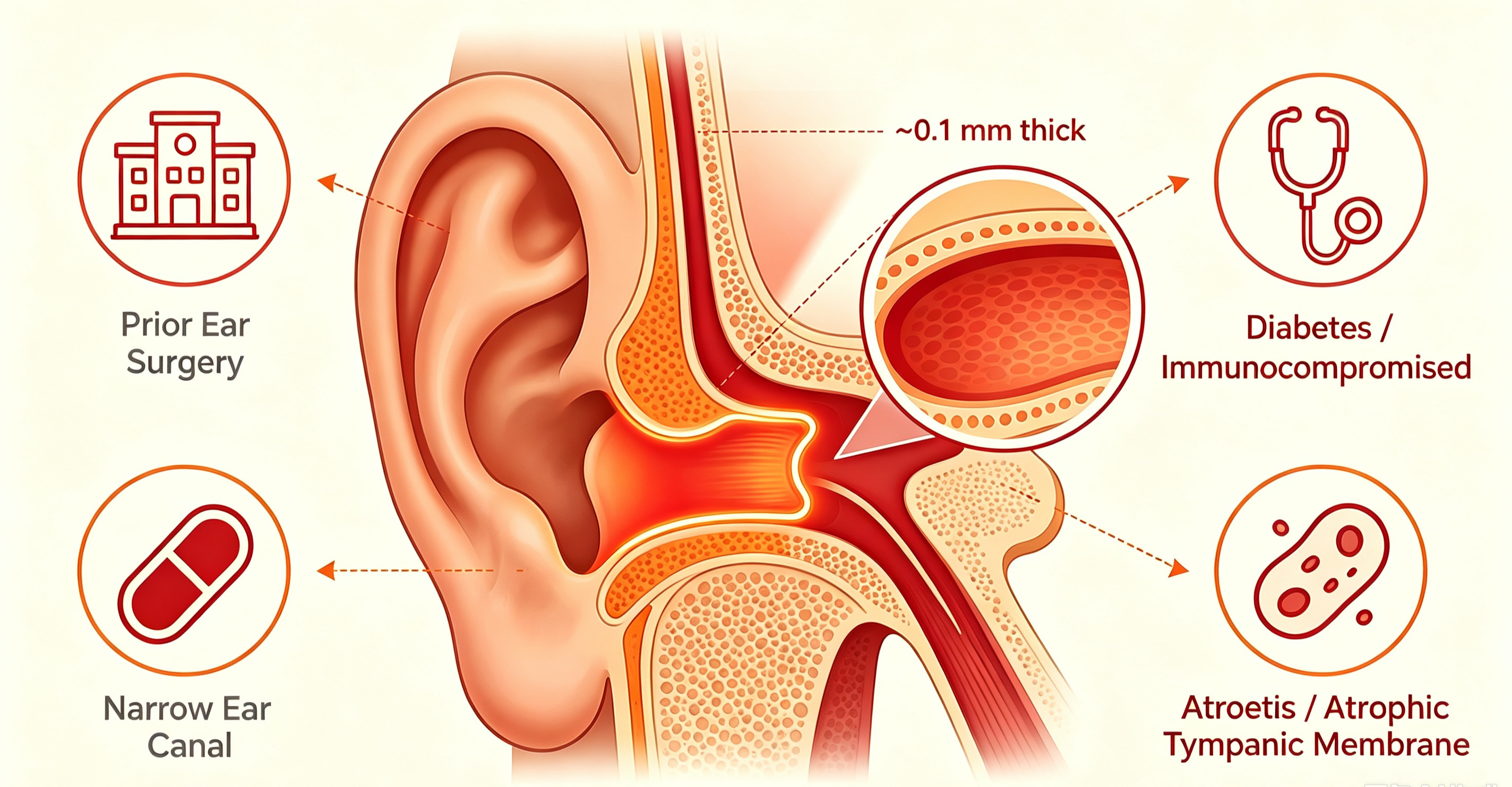 blind ear irrigation versus visualized pulsatile irrigation with endoscopic guidance comparison blind ear irrigation versus visualized pulsatile irrigation with endoscopic guidance comparison