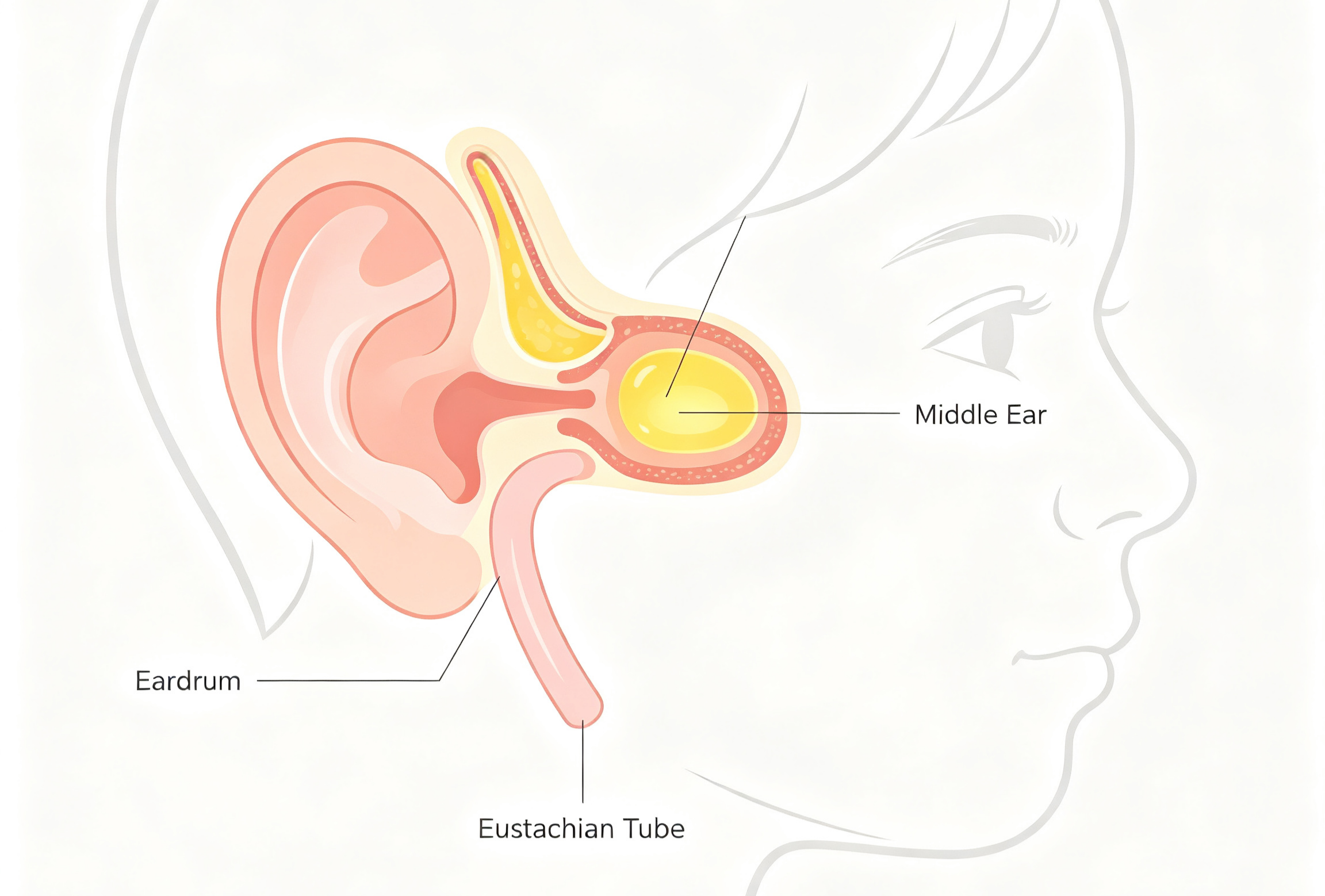 ear-tubes-for-kids-guide.jpg ear-tubes-for-kids-guide.jpg
