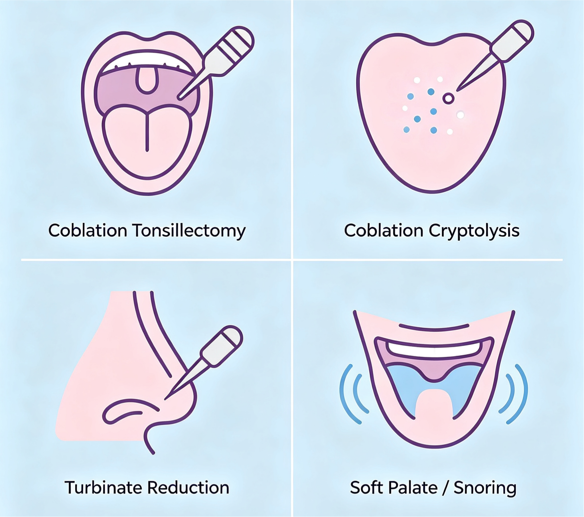 coblation-system-technology-concept-illustration coblation-system-technology-concept-illustration