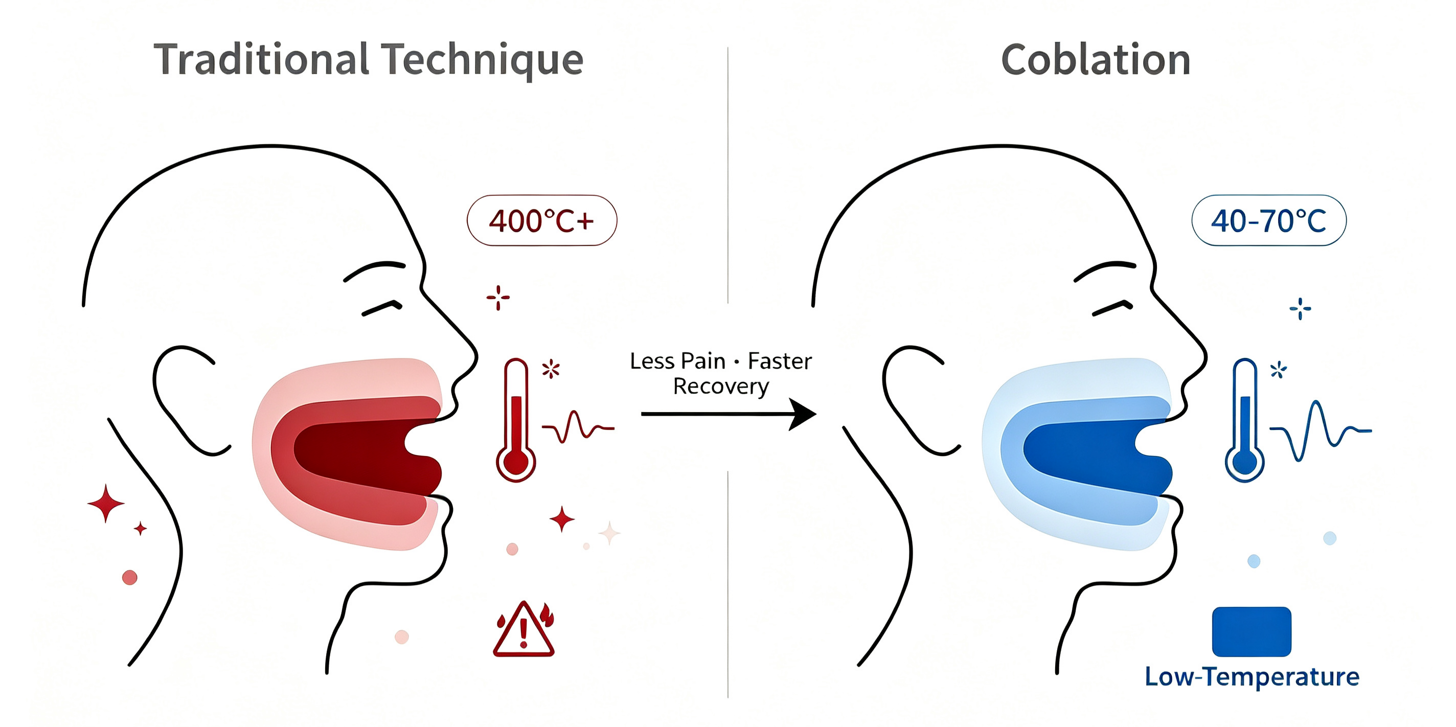 coblation-system-technology-concept-illustration coblation-system-technology-concept-illustration