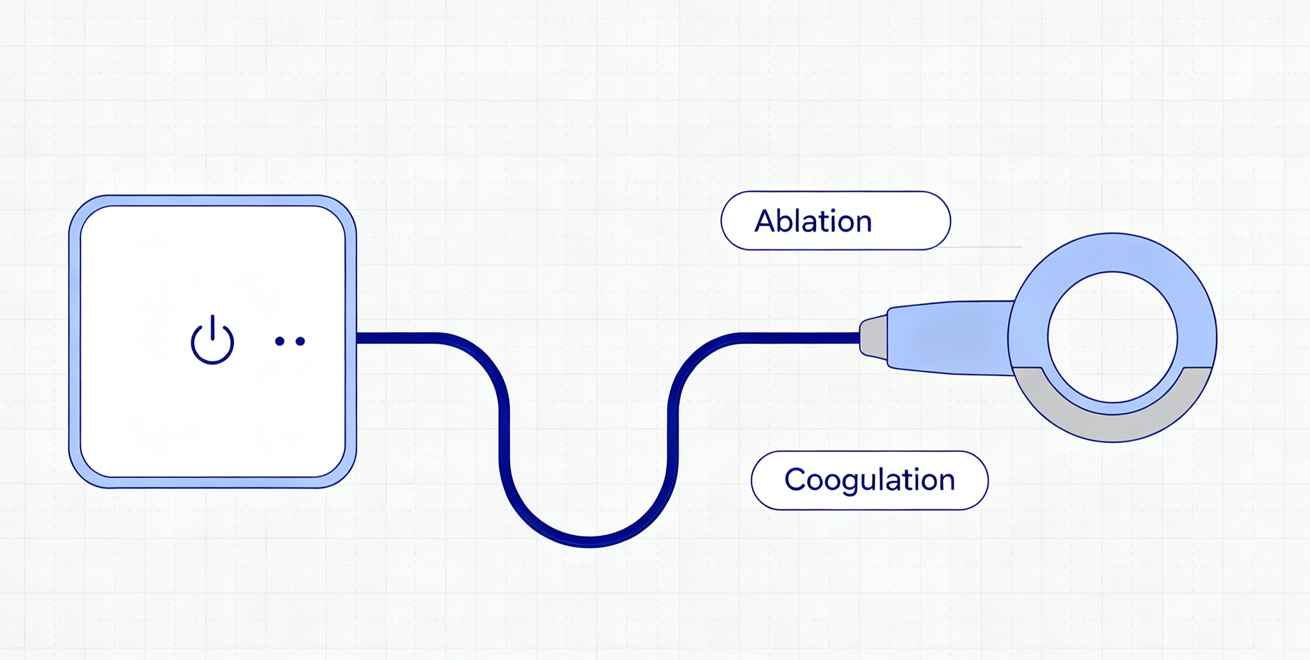 coblation-wand-vs-plasma-electrode-header-illustration.png coblation-wand-vs-plasma-electrode-header-illustration.png
