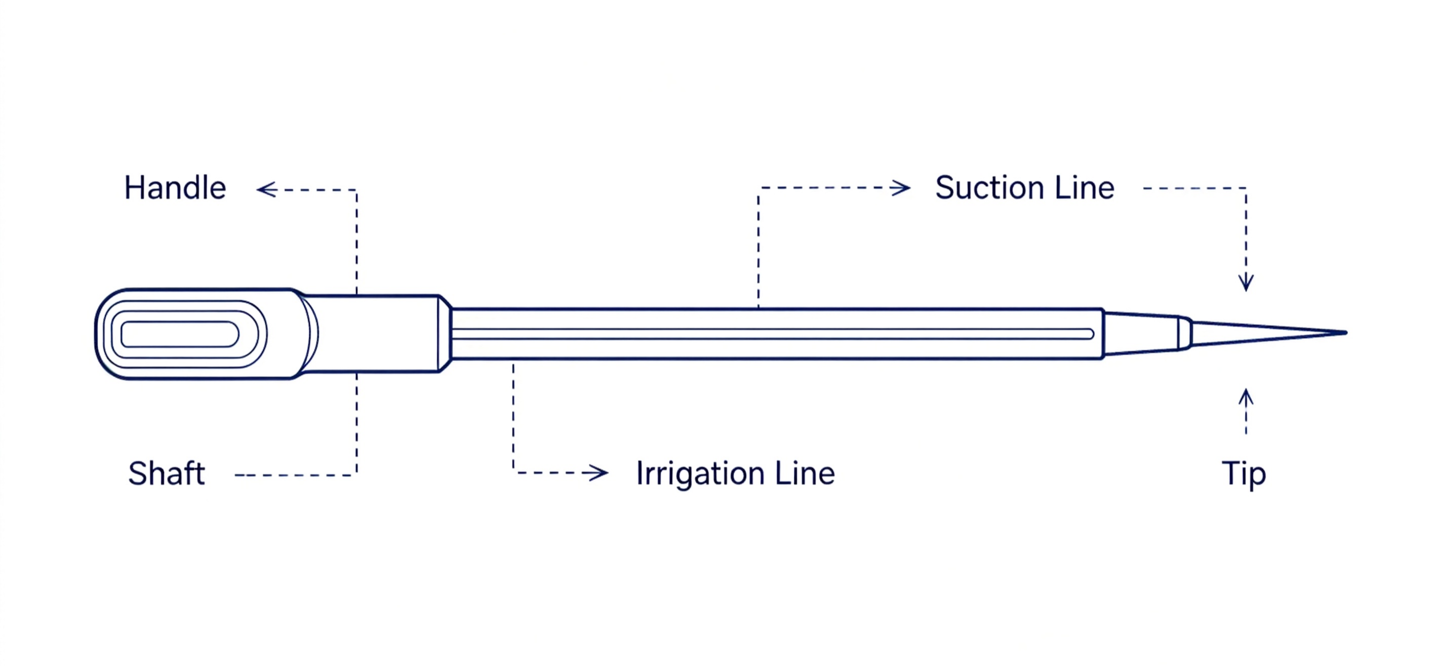 coblation-plasma-technology-concept-illustration.jpg coblation-plasma-technology-concept-illustration.jpg